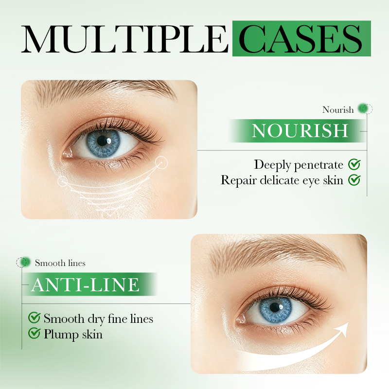 60 stuks SADOER Centella Asiat - Collagen Under Eye Patches recensie en prijs