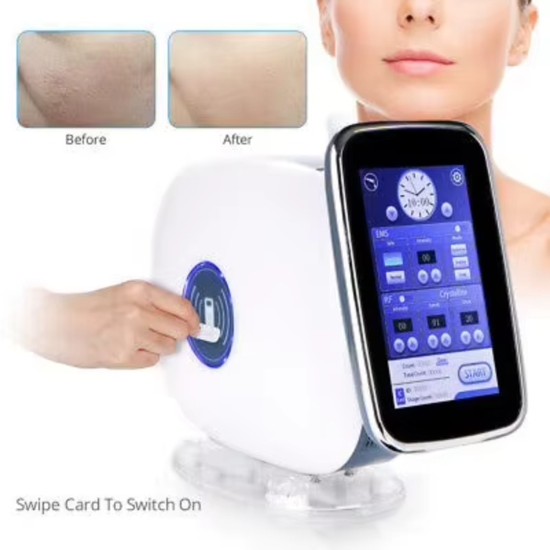 EMS RF Mesotherapie-apparaat z - Skincare recensie en prijs